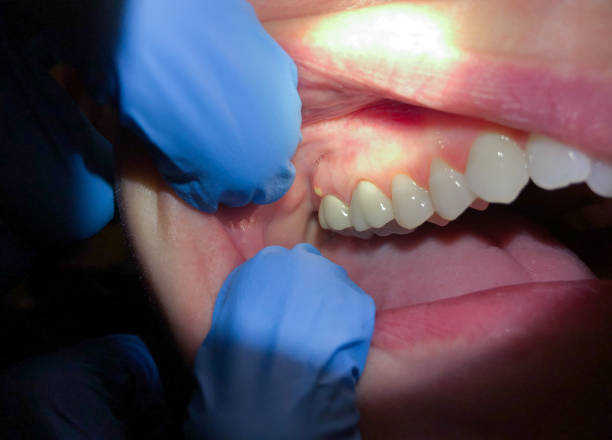 Best Emergency Treatment for Jaw Pain or Injury in Huntington Woods, MI
