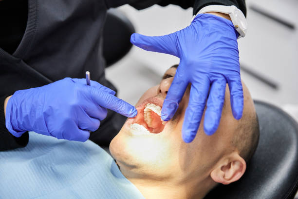 Best Emergency Dental Care for Sports Injuries in Huntington Woods, MI
