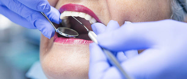 Best Emergency Cosmetic Dentistry (e.g., broken veneers) in Huntington Woods, MI